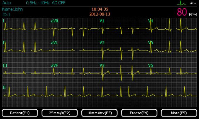 Built In Battery 30m Paper Length 6 Channel Ecg Machine Standard Version 1