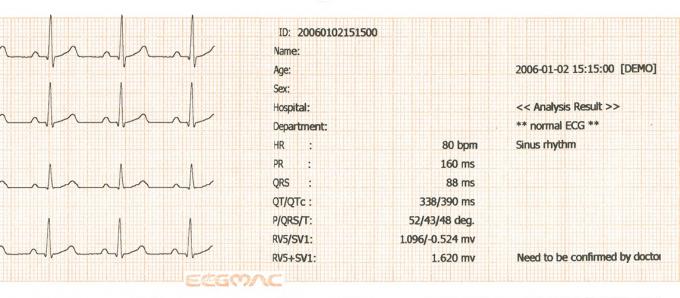 Standard Version Class II 3 Channel Portable ECG Machine 0