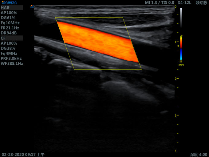 3D Ultrasound Pregnancy 220V 110V Color Doppler Ultrasound Machine Color Ultrasound For Abdomen BTH-150S 3