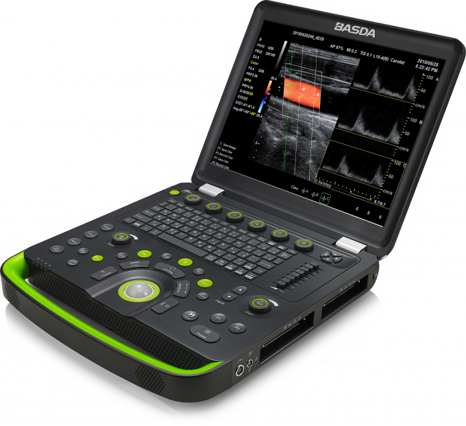 3D 2 Probe Sockets Portable Color Doppler Ultrasound Machine BTH-50S 1