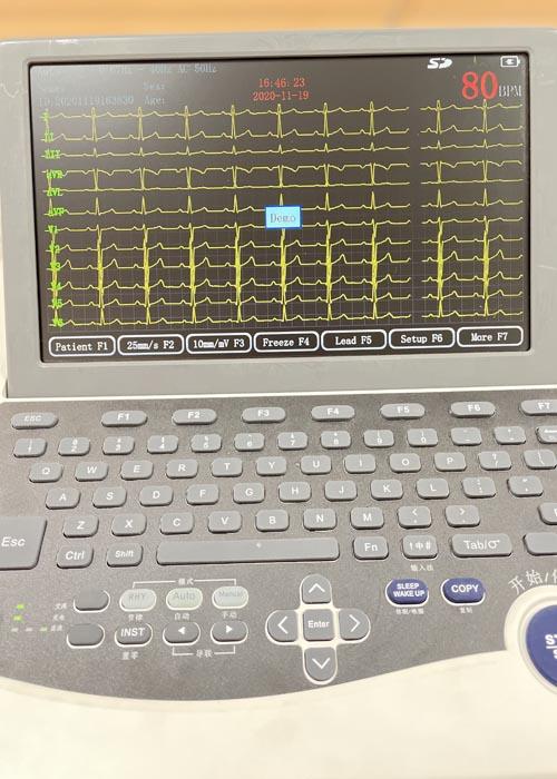 10.2inch 12 Lead Portable ECG Machine 2