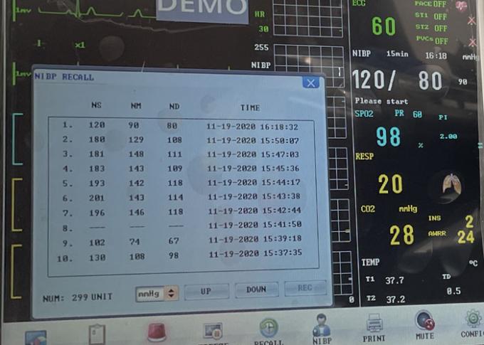 50mm*30m Paper Luxury 8 Inch Patient Monitoring Machine 0