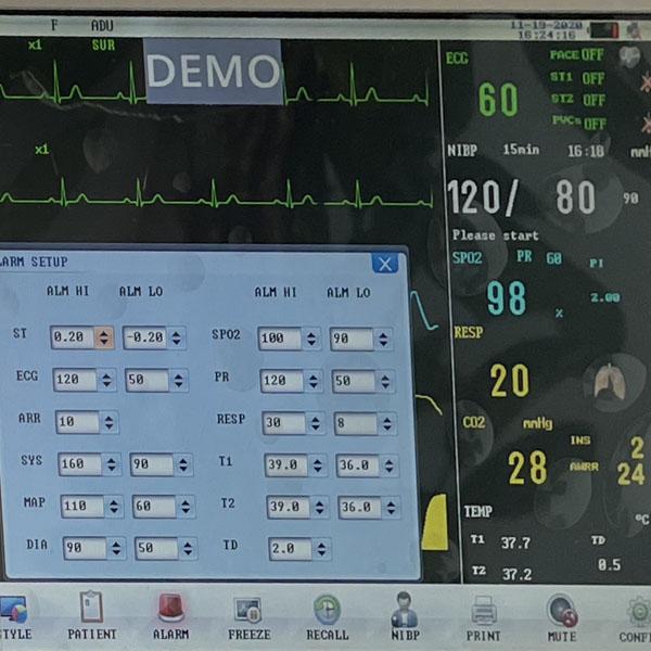 Basda ETCO2 IBP Patient Monitoring Machine / Bedside Cardiac Monitor 0