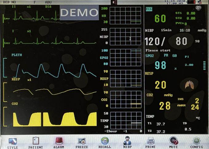 8-inch, 12-inch, 15-inch Patient Monitoring Machine ECG Monitors 1