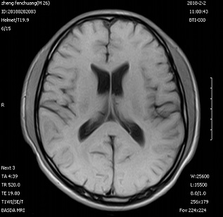 Self Shielding Permanent Whole Body 0.3 Tesla Basda MRI BTI-030 0