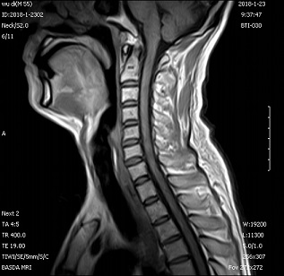 Self Shielding Permanent Whole Body 0.3 Tesla Basda MRI BTI-030 1