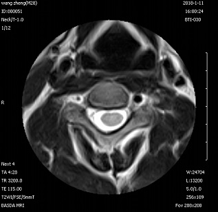 Self Shielding Permanent Whole Body 0.3 Tesla Basda MRI BTI-030 2