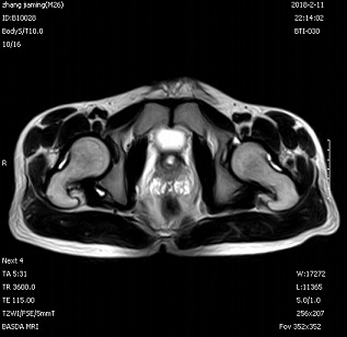 Self Shielding Permanent Whole Body 0.3 Tesla Basda MRI BTI-030 3