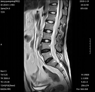 Self Shielding Permanent Whole Body 0.3 Tesla Basda MRI BTI-030 4