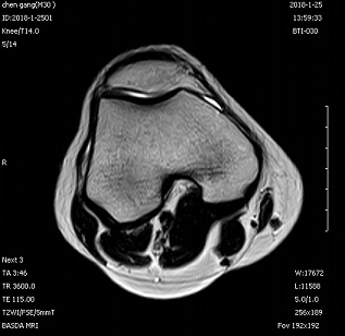 Self Shielding Permanent Whole Body 0.3 Tesla Basda MRI BTI-030 5