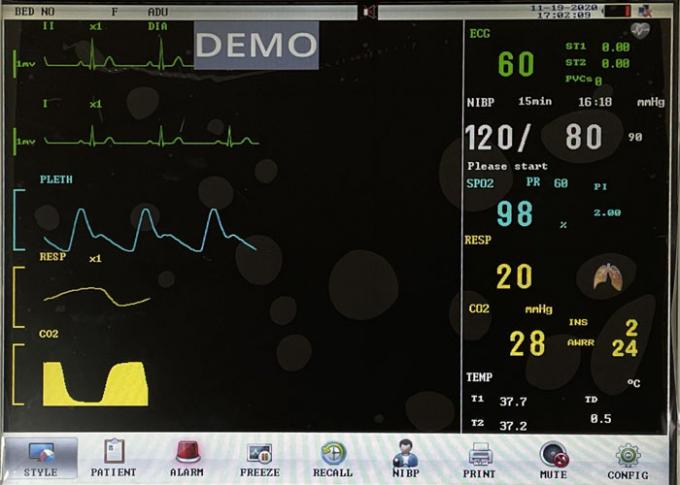 Multi Parameters Patient Monitoring Machine 1