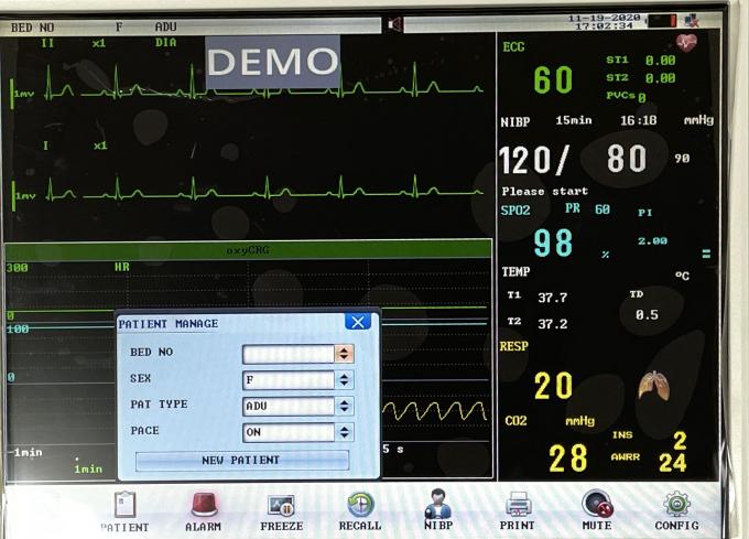 Basic Edition 100-240V 5 Channel Patient Monitoring Machine 1