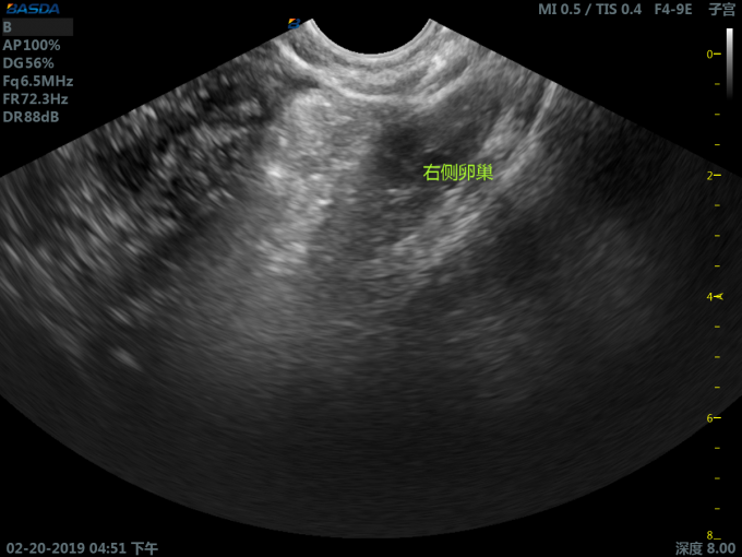 4 Sockets 4D Hospital Ultrasound Machine 3D Ultrasound Pregnancy Color UltrasoundBTH-300S 2