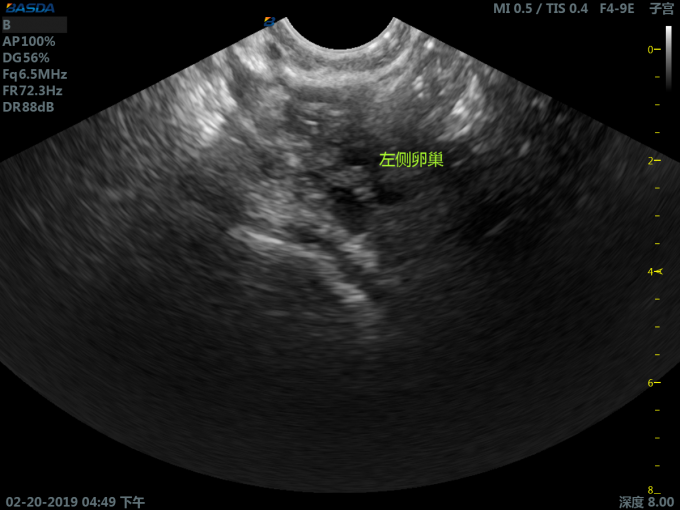 2.5-6.5MHz Convex Probe Color Ultrasound 3D Ultrasound Pregnancy Medical Ultrasound Machine With 21inch Monitor BTH-200S 0