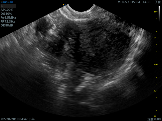 2.5-6.5MHz Convex Probe Color Ultrasound 3D Ultrasound Pregnancy Medical Ultrasound Machine With 21inch Monitor BTH-200S 2