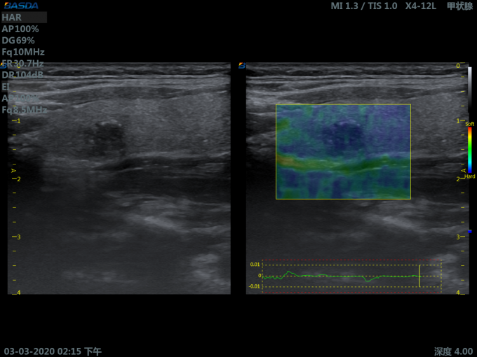 3D Ultrasound Pregnancy 220V 110V Color Doppler Ultrasound Machine Color Ultrasound For Abdomen BTH-150S 1