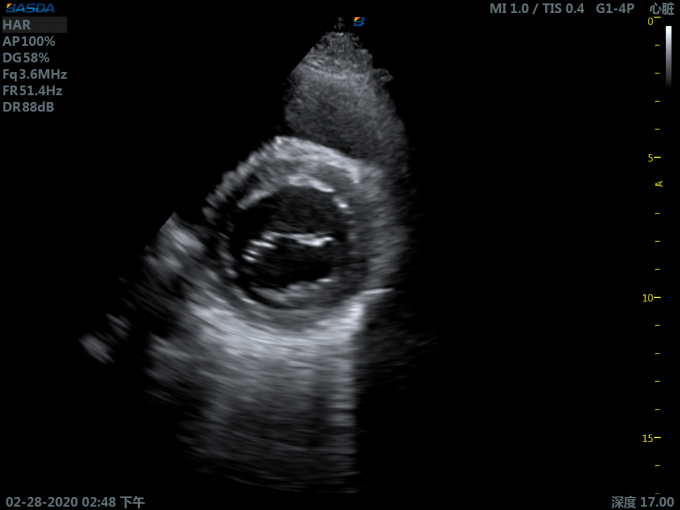 NMPA Certified 3D Ultrasound Pregnancy 220V Diagnostic Ultrasound Color UltrasoundMachine BTH-150S 2
