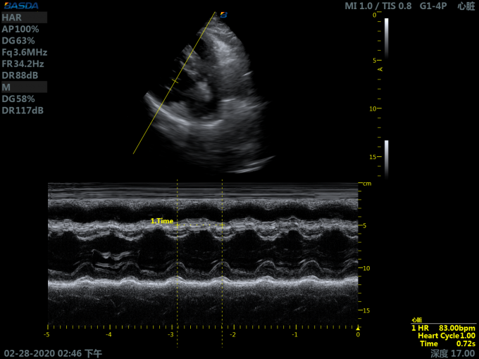 10 inch Touchscreen 4D Ultrasound 3D Ultrasound Pregnancy Equipment Color UltrasoundFor Obstetrics Gynecology BTH-150S 3