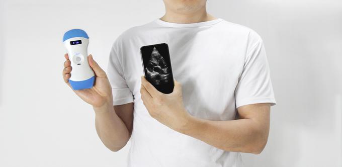 Handheld Wireless Dual Head 3 in 1 Mobile Ultrasound Machine 0