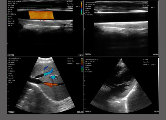 Digital Mobile Handheld Portable Ultrasound Device Convex Wireless Whole Body Ultrasound 0