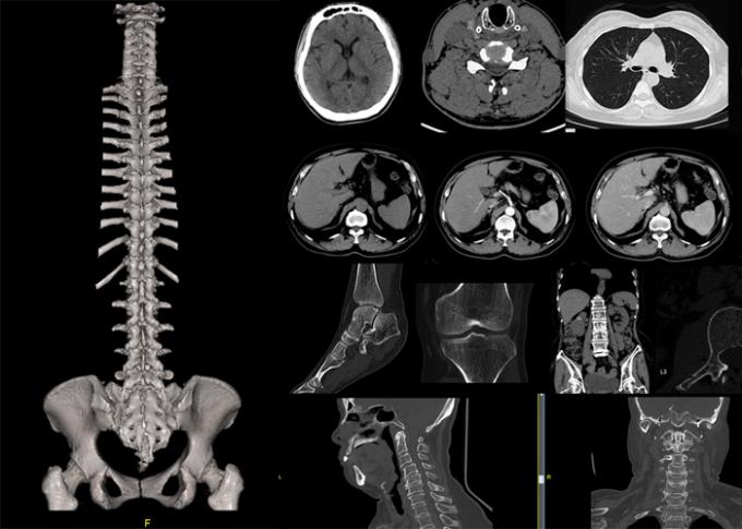 5.3MHU 64 Slice CT Scan Machine 1