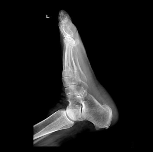 FPD Digital X Ray Machine BTR-X500 0