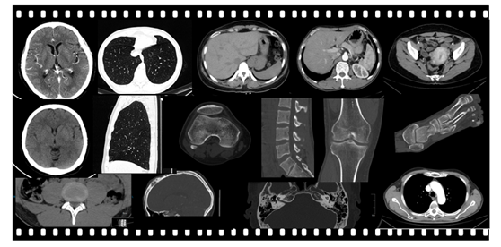 5.3MHU 64 Slice CT Scan Machine 0