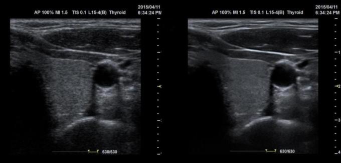 128 Array Portable Ultrasound Scanners Convex Probe 3D Color Doppler BTH-50S 1