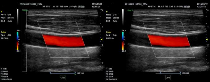 128 Array Portable Ultrasound Scanners Convex Probe 3D Color Doppler BTH-50S 3