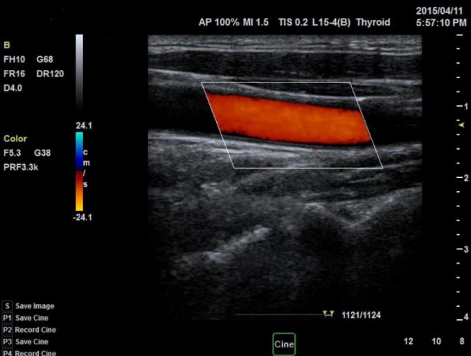 128 Array Portable Ultrasound Scanners Convex Probe 3D Color Doppler BTH-50S 2
