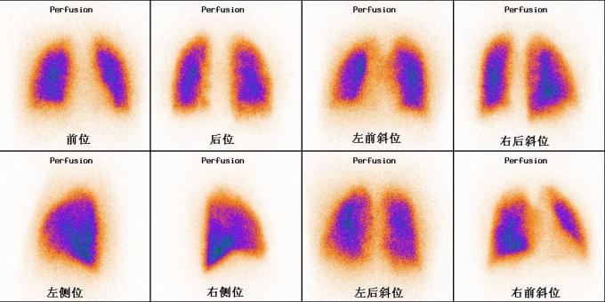 380V Sodium Iodide Nuclear Medicine Equipment Single Photon Emission Tomography 0