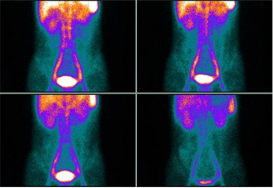 380V Sodium Iodide Nuclear Medicine Equipment Single Photon Emission Tomography 4