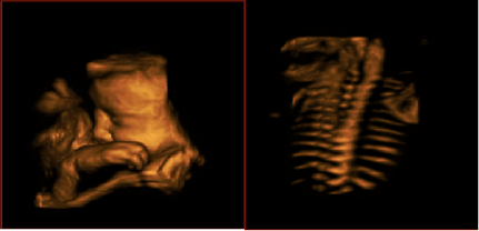 4 Sockets 4D Cartbase Medical Ultrasound Machine 0