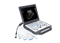 China Multi-Probes 15inch Portable Ultrasound Scanners BTH-20S company