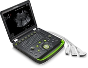 COLOR DOPPLER ULTRASOUND, PORTABLE TYPE, EXCELLENT IMAGES, WITH BACKUP POWER, CAN BE USED FOR OUTDOOR DIAGNOSIS BTH-50