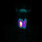 Gamma Camera Nuclear Medicine Machine Parallel Collimator 1.5mm UFOV