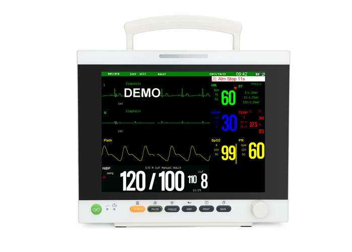4AH Rechargeable Patient Monitoring Machine 800×600 Dpi 12.1&quot; TFT 6 Parameter