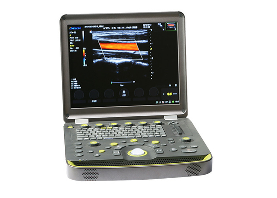 China NMPA Andrology Doppler Ultrasound Machine 3D Color IMT BTH-50 factory